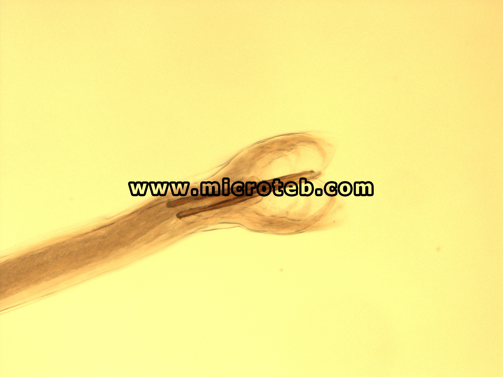 استرتاژیا سیرکومسینکتا -  Ostertagia circumcincta