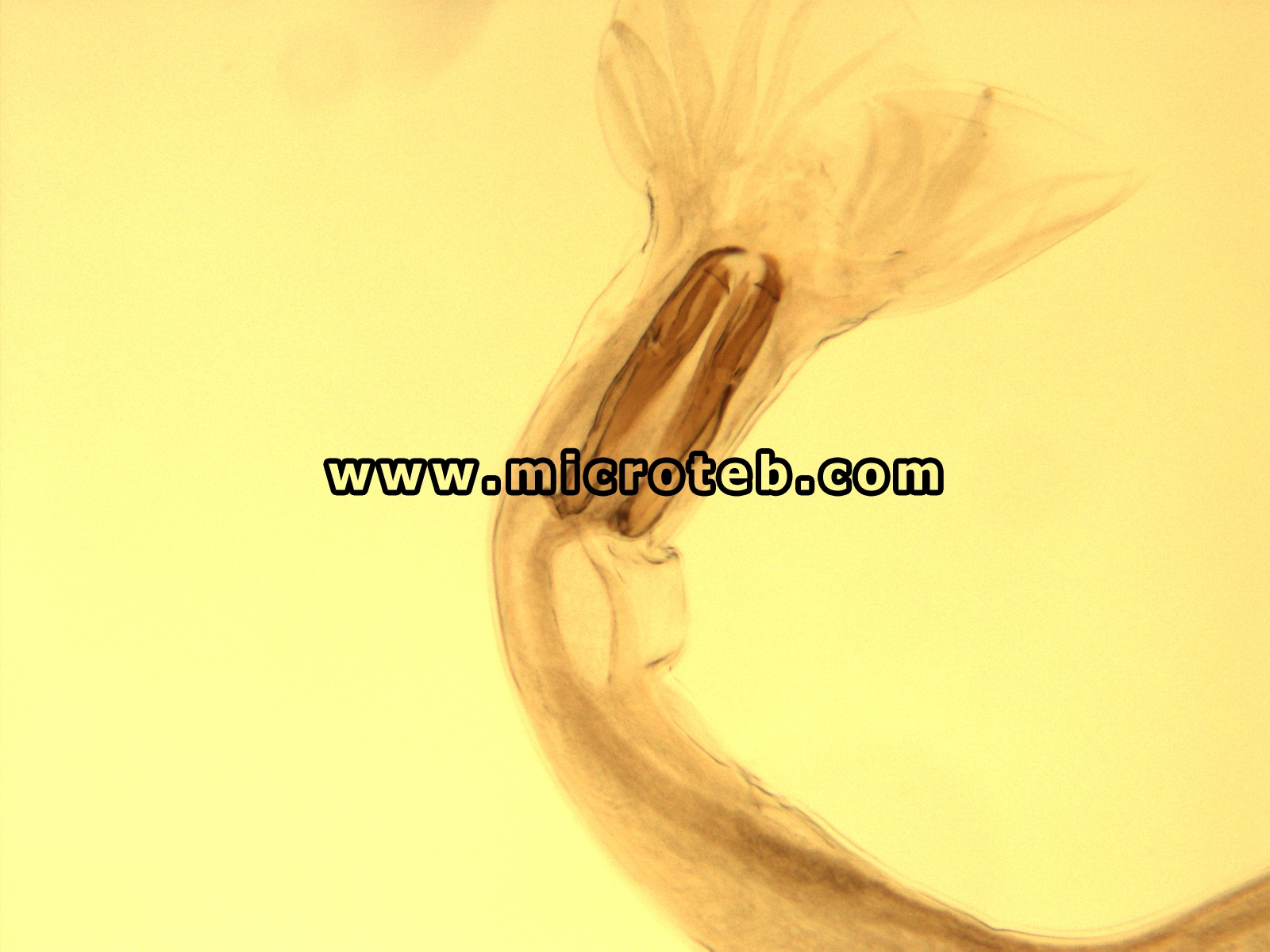 استرتاژیا اکسی دنتالیس -  Ostertagia occidentalis