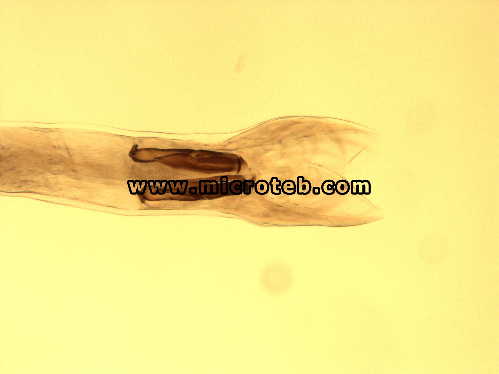 استرتاژیا اکسی دنتالیس -  Ostertagia occidentalis
