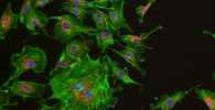 Fluorescence imaging of BPAE cell by DigiRetina 16