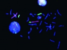 FISH Metaphase