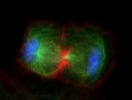 FISH Metaphase